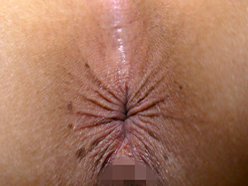 尻肉と肛門を凝視する　サンプル画像06